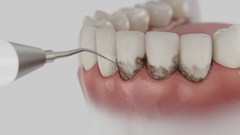 Trusted Teeth Cleaning And Checkup service in Aloha, OR - Dentist Open Now